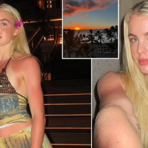 Keely Hodgkinson sparks concern as she displays her very sunburnt chest while posing in a tiny crop top during lavish holiday in Hawaii